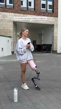 One-Leg Amputee Girl Jumping Rope with Prosthetic Leg | Disability Is Not Inability