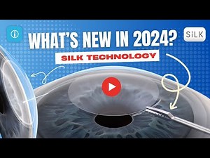 The Evolution of LASIK Technology: What’s New in 2024? SILK Technology