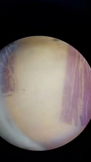 Striated or Skeletal muscle under the microscope
