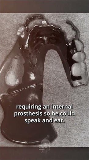 Sigmund Freud's fight against cancer