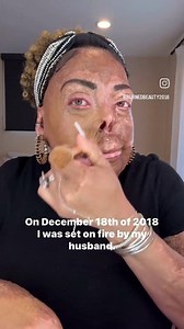 Despite the pain and challenges, she courageously shares her story of resilience, strength, and survival, showing that even in the darkest moments, hope can light the way. There is something extraordinary about women who refuse to give up—they rise, rebuild, and inspire. We salute your courage @burnedbeauty2018 💡 Read inspiring stories of inspiring women on womenofrubies.com. See the link in our bio. Follow @womenofrubies_ #BurnSurvivor #Resilience #StrengthInAdversity #Hope #SurvivorStory #Hea