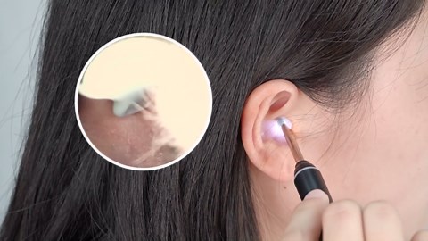 VITCOCO Ear Wax Removal Tool, 1920P HD Ear Cleaner with 6 LED Lights, 3mm Mini Visual Ear Camera, Ear Cleaning Kit for iPhone, iPad, Android