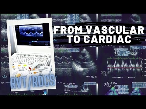 Life of a Registered Vascular Sonographer | Learning Echocardiography in the field