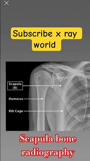 Scapula bone radiography!! scapula bone k x ray!! #trendingshorts #medicalimaging #radiology #xray