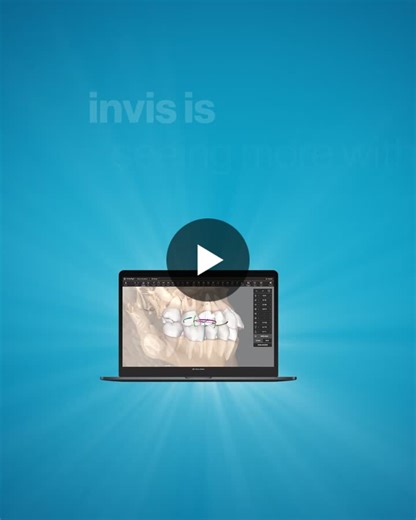 Integrate CBCT data with ClinCheck for comprehensive treatment planning | Invisalign South Africa posted on the topic | LinkedIn