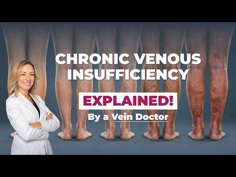 Chronic Venous Insufficiency Explained | Causes, Symptoms and Treatment Options