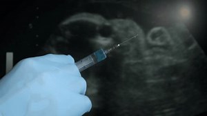 Gynecologist Hold Syringe Hand View Injection Stock Footage Video (100% Royalty-free) 3781370457 | Shutterstock