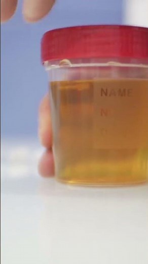 Understanding DOT Drug Testing for Drivers