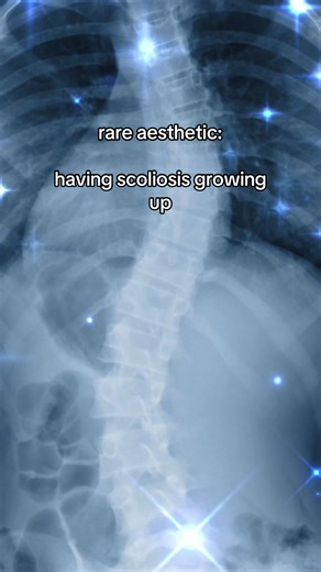 rare aesthetic | SCOLIOSIS AWARENESS #scoliosis #awareness #viral #rareaesthetic #chronicillness