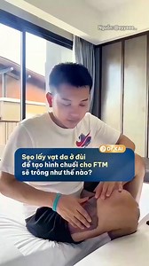 Sẹo to như thế này thì có đau không? Cùng tìm hiểu với bác sĩ nhé! #DrKai #KAIMed #transgender #KAIMe #suckhoe #FTM | Ngô Hải Sơn