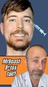 #mrbeast and his non Duchenne smile.