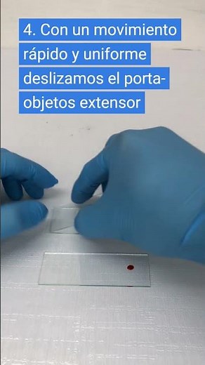 ¿Cómo se hace un frotis o extendido de sangre periférica? #laboratorioclinico #hematologia #shorts