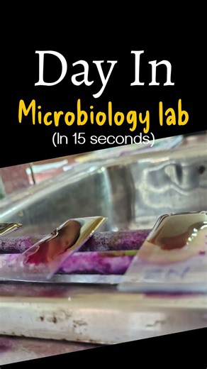 A day in #microbiology lab 🧫🧪 (Acid Fast Staining)