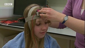 Electrical brain stimulation could be used to help stroke patients with recovery. Researchers in Oxford have been trialling the technique at the John Radcliffe Hospital and say early results show it improves mobility, grip and control http://bbc.in/1U91PJ3 | BBC Hampshire & Isle of Wight