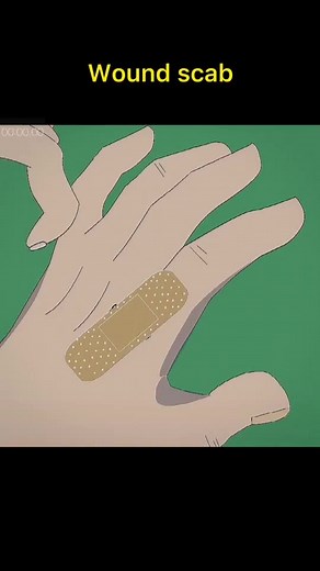 Proper Wound Care: When to Remove Scabs Safely