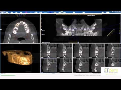 Tips and Tricks i-CAT Vision