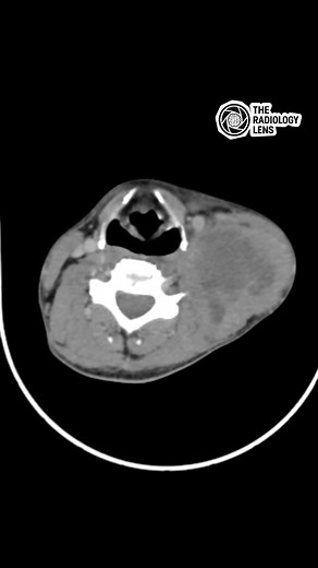 49K views · 249 reactions | Diagnosis⬇️ #Neuroimaging #TheRadiologyLens #Radiology #MedicalImaging#Radiologist | The Radiology Lens | Facebook