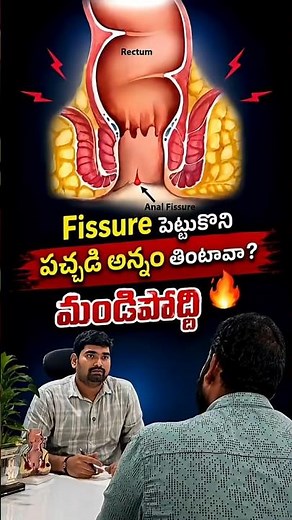 🚨​Ouch... Sharp pain down there? 😣Acute vs. Chronic Anal Fissures