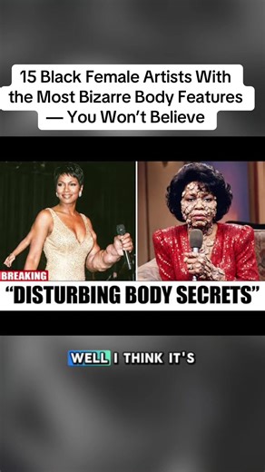 15 Black Female Artists With the Most Bizarre Body Features — You Won’t Believe