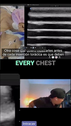 Sliding Lung Assessment! Ultrasound Tutorial You NEED to Know! #shorts