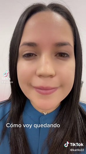 El botox para bruxismo nos ayuda a relajar el músculo masetero lo cual tiene como efecto secundario afinar el tercio inferior de la cara ✨ El botox para prevenir arrugas nos ayuda a evitar que se nos marquen esas líneas en la frente, entrecejo y patas de gallo ✨. El botox también puede levantar tu mirada y hacer que luzcan tus ojos más altos lo cual te da un aspecto más juvenil. ✨#botoxnatural #ecuador🇪🇨 #armonizacionorofacial #antesydespues