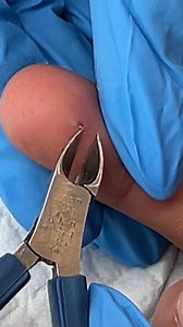 4.5M views · 10K reactions | They Got it out so quickly  part 3 | Laguna Short Films | Facebook