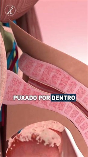 Dor na ereção e Doença de Peyronie