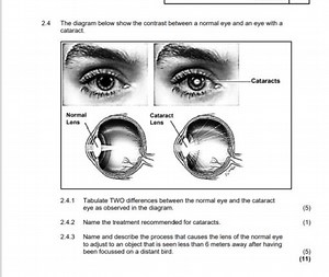 Question 2.4: The Normal Eye vs. Eye with Cataract2.4.1 Tabul... | Filo