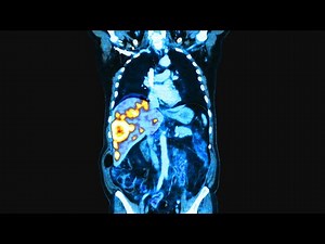 A Soldier Was Exposed To A Burnpit. This Is What Happened To Her Organs.