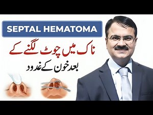 Septal Hematoma | Blood Clot in Nose After Injury | Causes, Symptoms & Treatment Explained