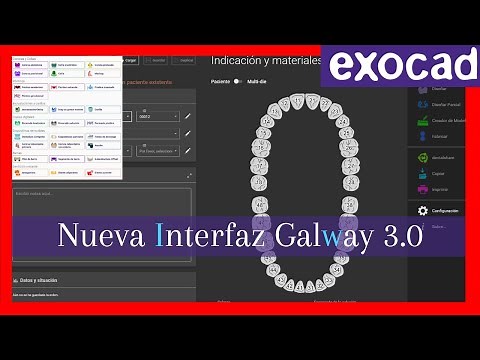 Nueva interfaz💥 exocad galway 3.0 dentaldb dentalcadapp