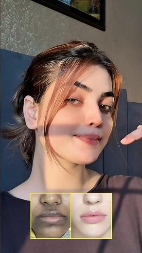 How to get rid of hyperpigmentation around the mouth & neck #shorts #youtubeshorts