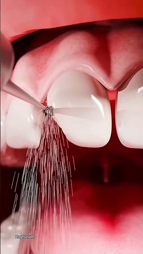how dentists repair a broken tooth 😱
