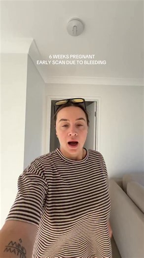 Danielle Mitchell on Instagram: "(Old post) 6 weeks pregnant, I have my first scan today, its a little early but it’s a doctors request! I knew we weren’t gonna see a heart beat buttttttt nothing could have prepared me for an empty sac, women having to stay silent in early pregnancy is crazy, having had gone thru this without leaning on a community was really hard I’m glad I can share it now."