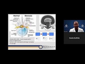 Interventional Treatment Options for Lumbar Radiculopathy and Low Back Pain