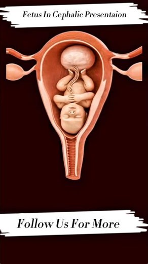 Fetus in Cephalic Presentation | Pregnancy Anatomy #pragnancy #pragnancy #fetaldevelopment #foryour