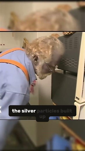 The Real Story of the Man with Blue Skin #TrueStory #MedicalHistory #IncredibleFacts #Documentary