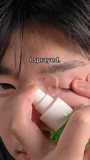 pimple came.I sprayed.pimple left. #skincare #kbeauty #pimple #acne #acnetreatment #toner #fyp