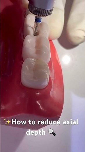 How to reduce axial depth 🔍| Dr.Dentique-hub