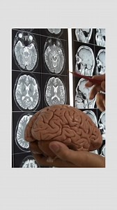 How Does a Brain Become Injured: Traumatic Brain Injury When the brain becomes injured due to an external force, it's classified as traumatic brain injury. Getting hit in the head by a ball, or colliding with an object or person, can lead to a head injury. Falls, in particular, are the leading cause of TBI. In fact, TBI is a common cause of liability and death in children and adolescents in the United States, with those from birth through age four being the most vulnerable. At the Family Hope Ce