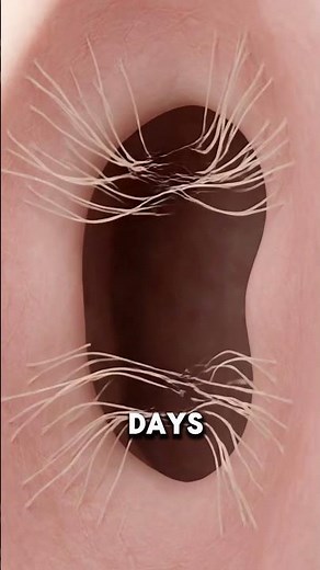 Why Do Scars Form? The Truth About Skin Healing 🧬✨