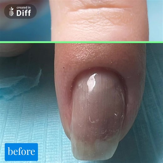 διόρθωση παράλληλων νυχιου#nailschool #manicureschool #nails #маникюр #beautymeacademykavala #ногти #beautynails #выравниваниеногтей