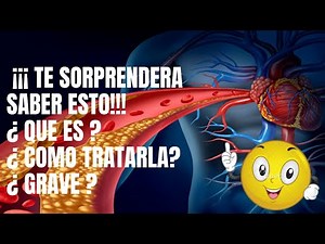 ARTERIOSCLEROSIS, SÍNTOMAS, CAUSAS Y TRATAMIENTO.