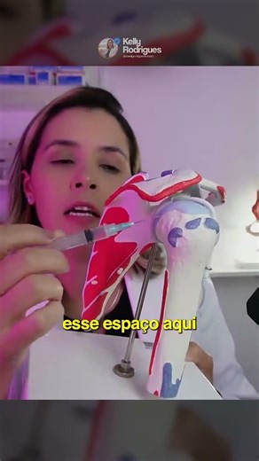 Qual a melhor via para infiltrar a bursa subacromial?