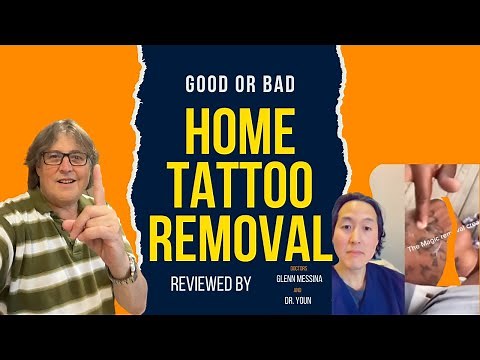 Home tattoo Removal Using Salt Reviewed by Dr. Messina & Dr. Youn, Is It Safe?