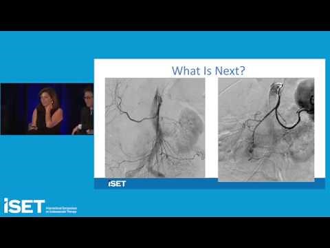 Hemorrhage: Embolization Strategies and Techniques