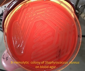 Staphylococcus aureus: Introduction, pathogenecity, lab diagnosis and