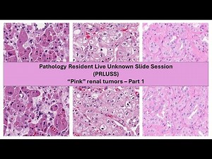 Pathology Resident Live Unknown Slide Session (PRLUSS) - Pink Renal Tumors, Part 1 (Pilot)