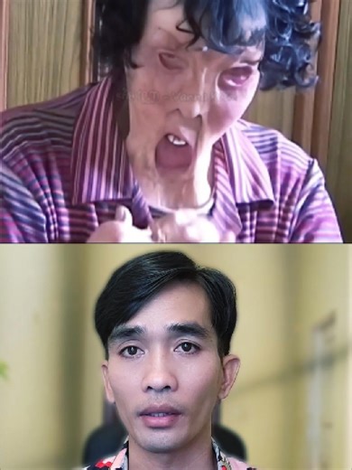 Inspiring Story of a Burn Victim's Resilience