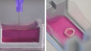 Researchers Could Soon 3D Print Bones Directly Into the Human Body